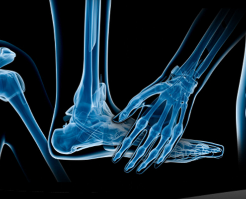 Cirugia_ortopedica_y_traumatologia-Traumatologia_y_Ortopedia-Osteoporosis-Sanidad-Salud_405221111_125199170_1706x960