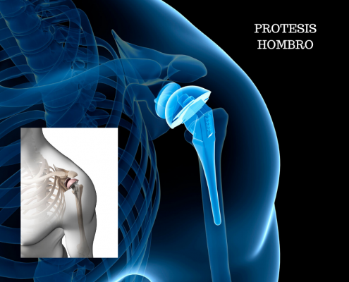 Hombro_Dira_Ceoti